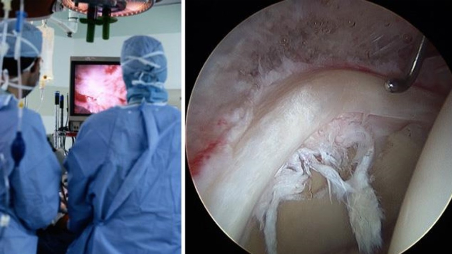 Arthroscopic Joint Repair