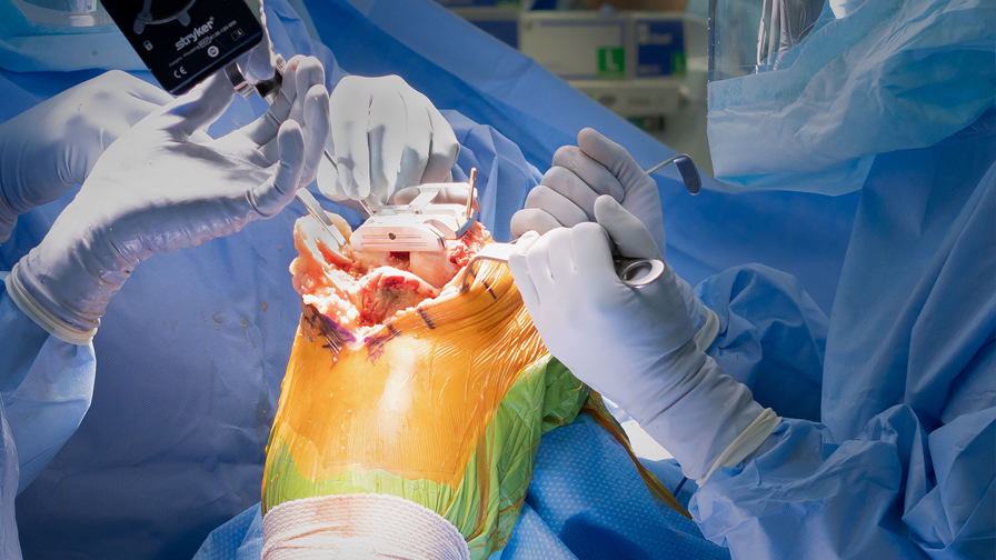 Arthroscopic Knee Surgery