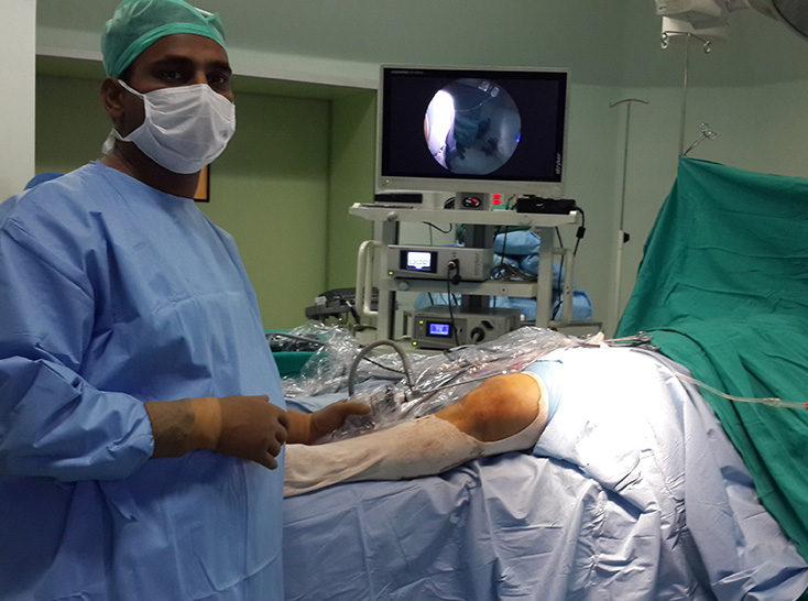 Arthroscopy Surgery